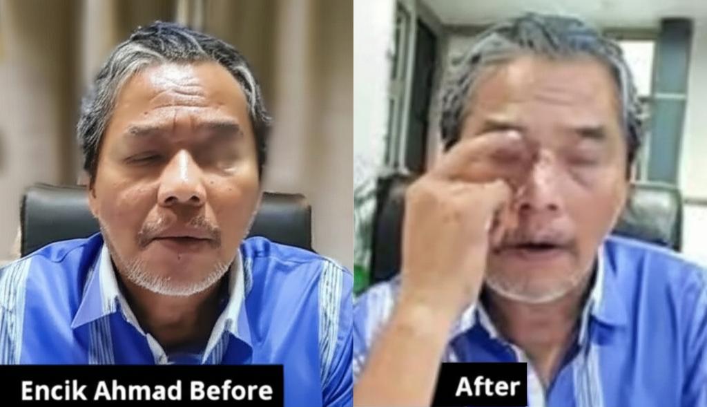 A before-and-after photo of Encik Ahmad, showing him looking tired and stressed in the 